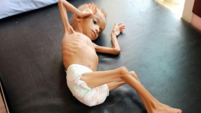 المملكة العربية السعودية تنتقد قرار مجلس حقوق الإنسان بالأمم المتحدة حول اليمن